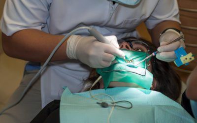 Root Canal Treatment in Pensacola, FL